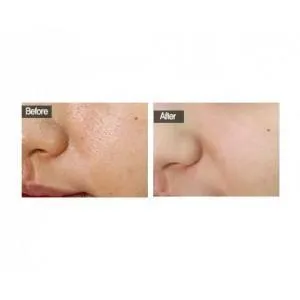 Absolute Pores Tightening Serum Mini