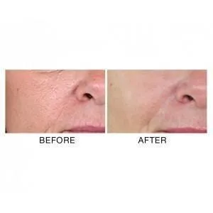 Absolute Pores Tightening Serum Mini