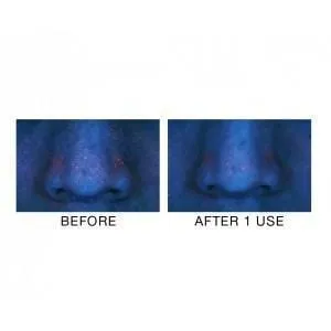 Absolute Pores Tightening Serum Mini