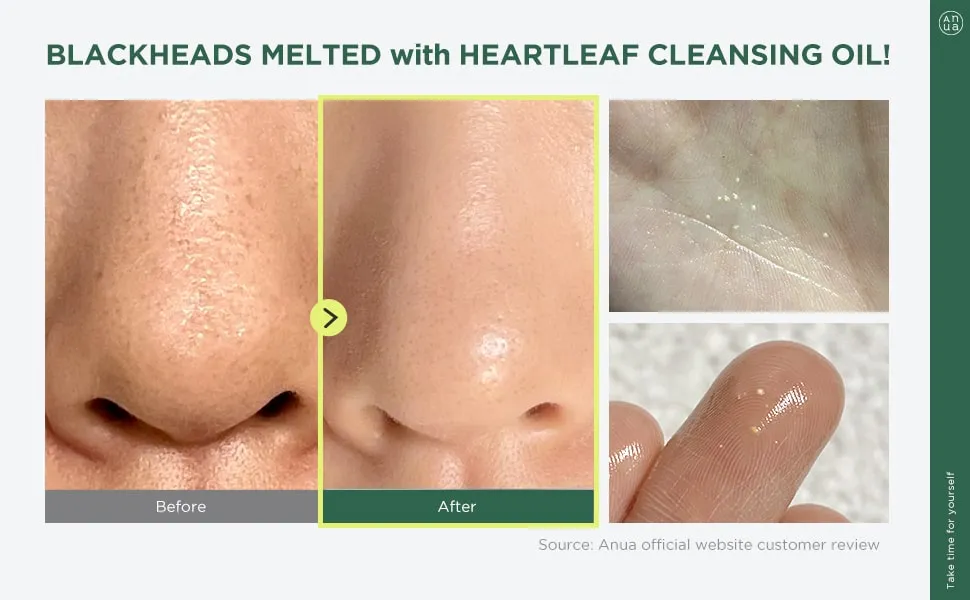 Anua Heartleaf Pore Control Cleansing Oil