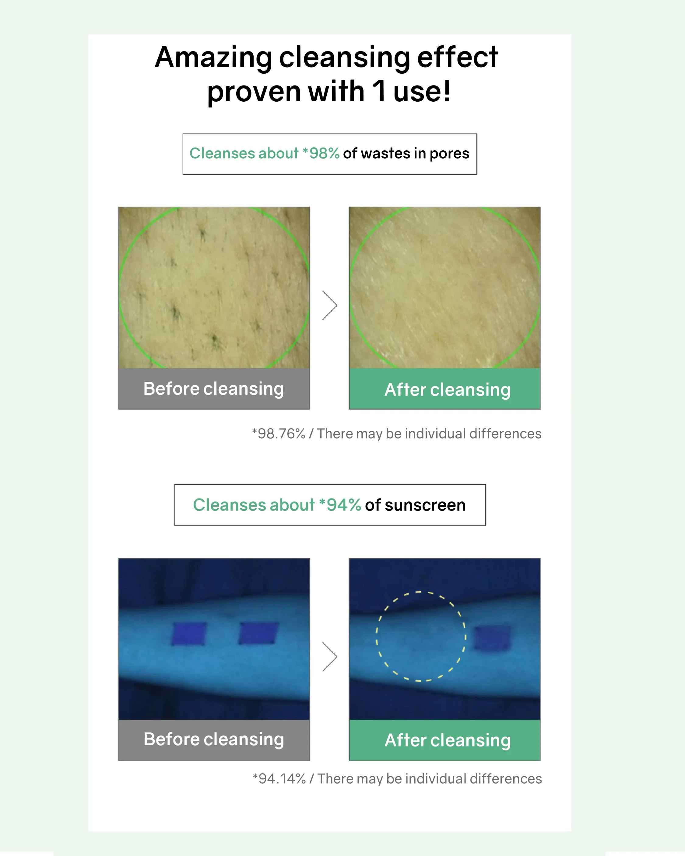 Bonabella Teatree Moist Soothing Cleanser
