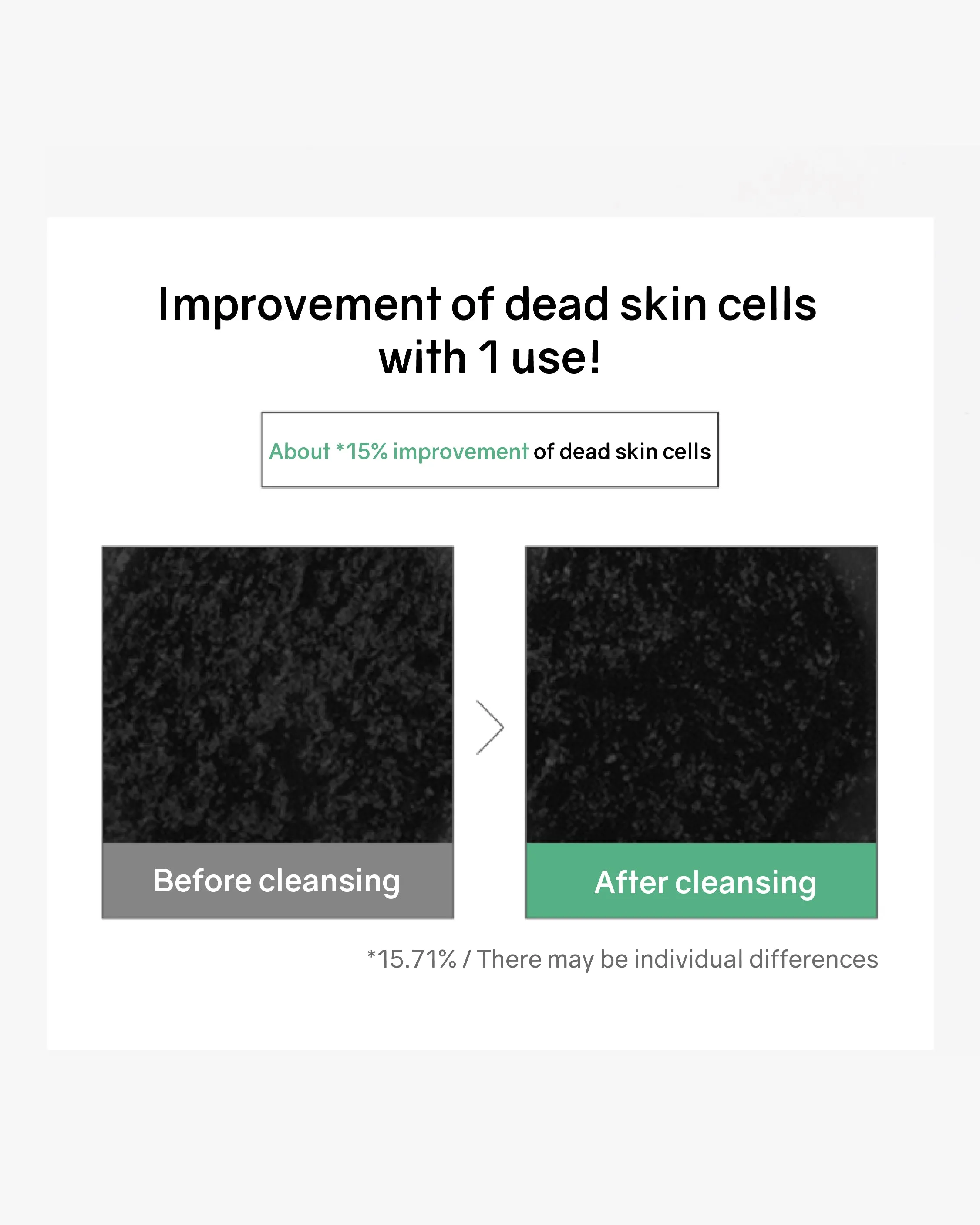 Bonabella Teatree Moist Soothing Cleanser