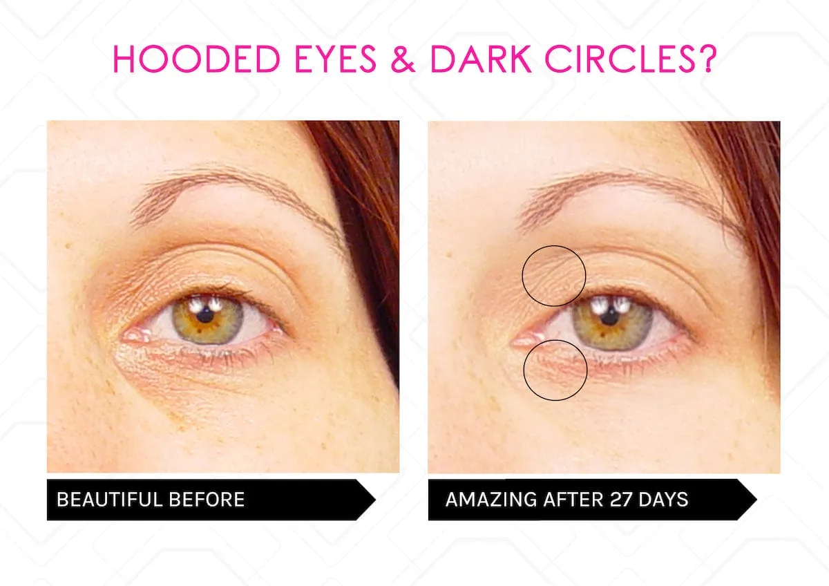 Power Lift Skin Saviours