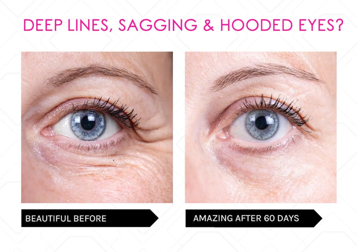 Power Lift Skin Saviours