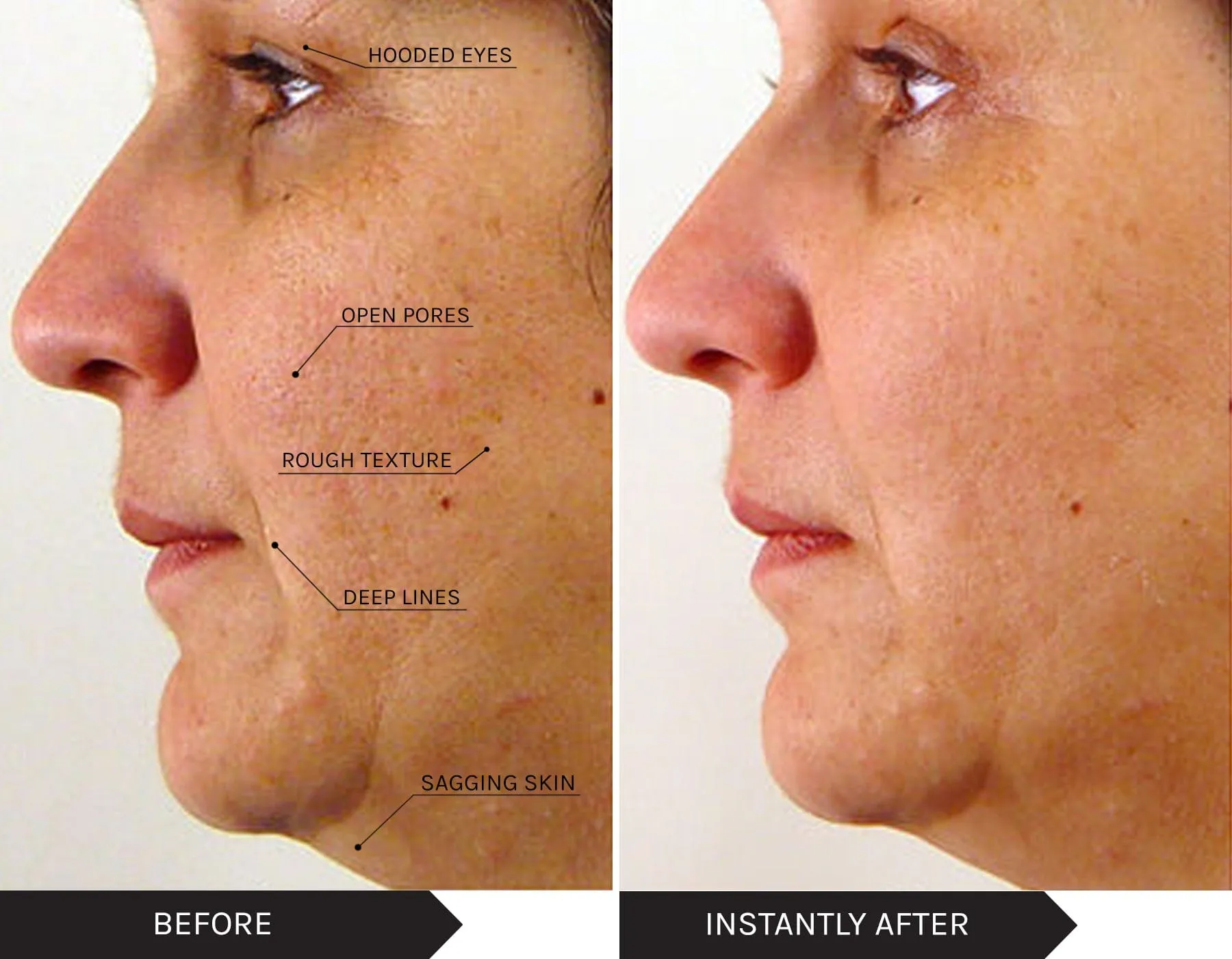 Power Lift Skin Saviours