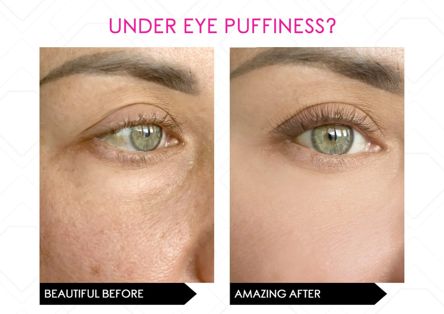 Power Lift Skin Saviours