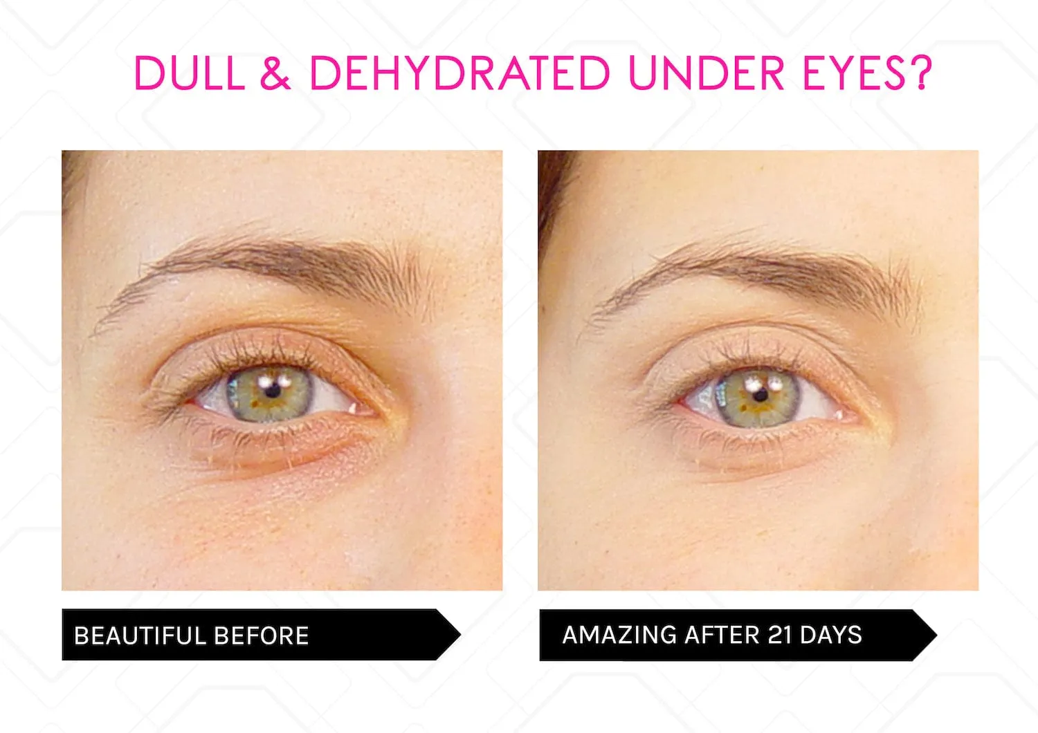 Restore Youthful Eyes - Powerful Eye Lift Serum Duo