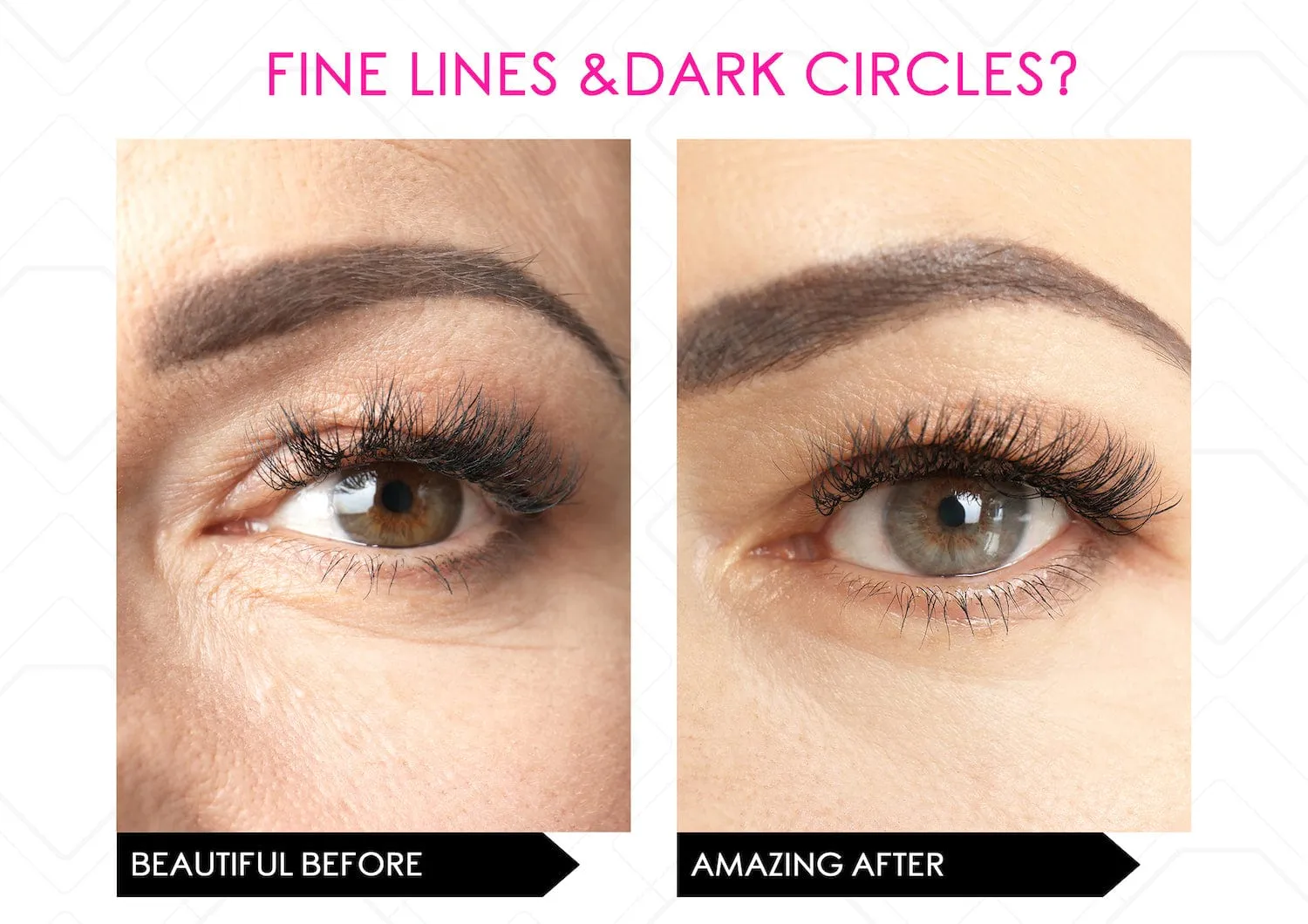 Restore Youthful Eyes - Powerful Eye Lift Serum Duo