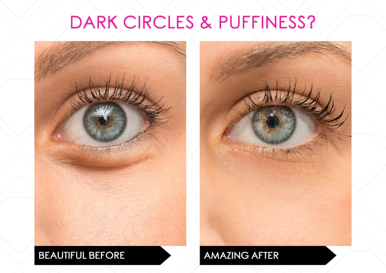 Restore Youthful Eyes - Powerful Eye Lift Serum Duo