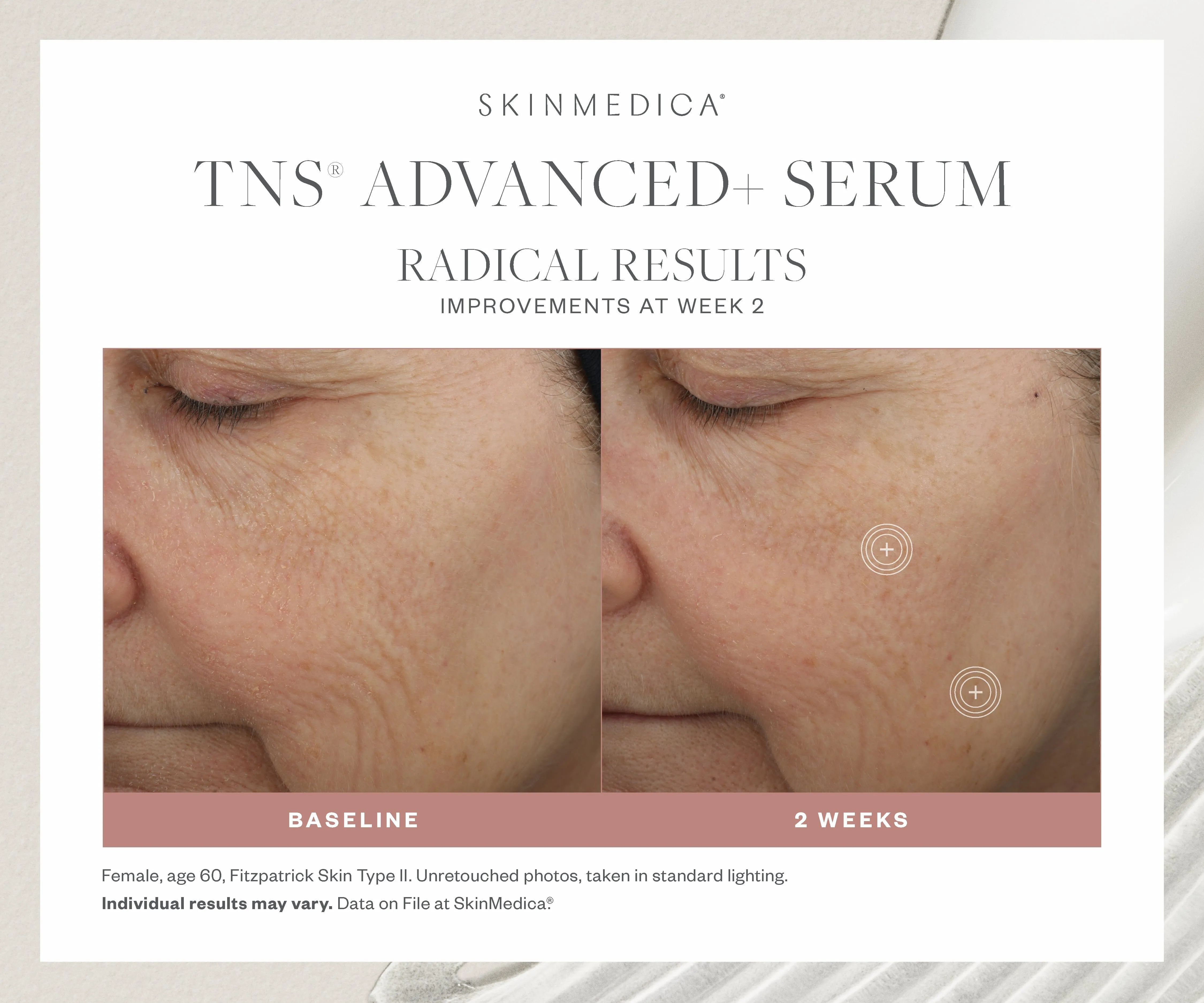 SkinMedica TNS Advanced  Serum
