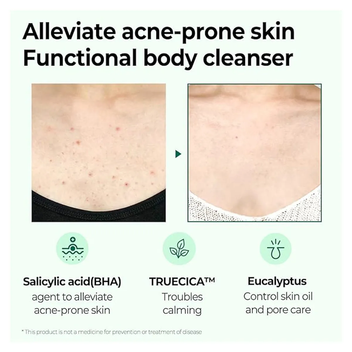 Some By Mi Aha Bha Pha 30Days Miracle Acne Clear Body Cleanser 400G